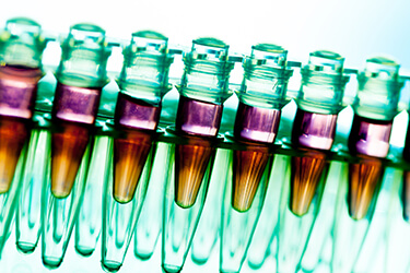 Medical test tubes linking unhealthy gums and cancer