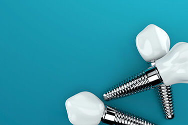 Dental implants on blue table offering the ultimate solution for optimal function and confident smiling.